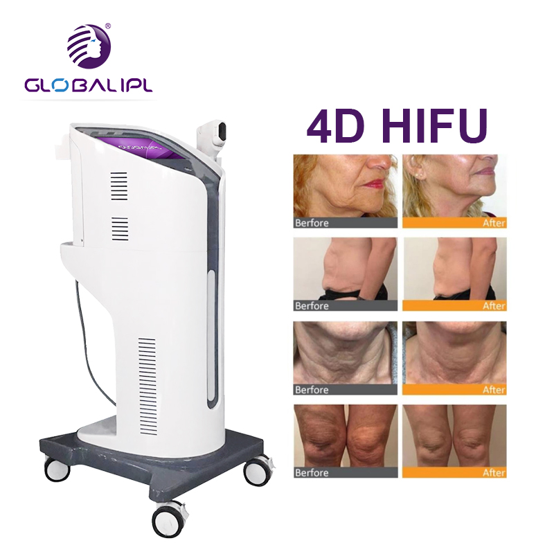 4D Hifu Facial Lifting Tightening Machine For Wrinkle Removal